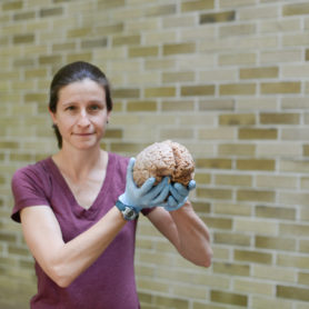 Jen Mozolic holding a brain